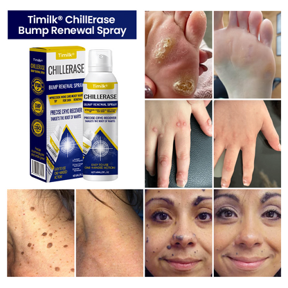 Timilk® ChillErase Bump Renewal Spray 🔥